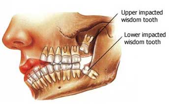 Oral Surgery